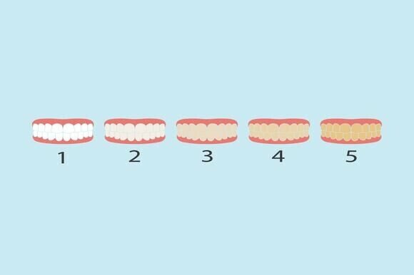 Understanding Tooth Color Level Vector Illustration: A Practical Guide for Designers and Professionals